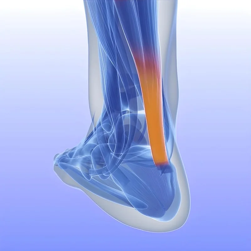 3D medyczna ilustracja ścięgna Achillesa